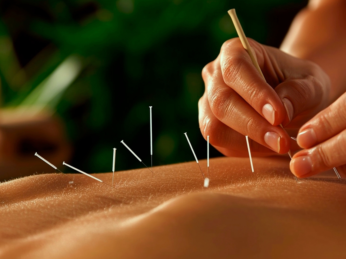 Dr. David Dung Phan offers Acupuncture, Herbal Medicine, Pain Management in Huntington Beach, California