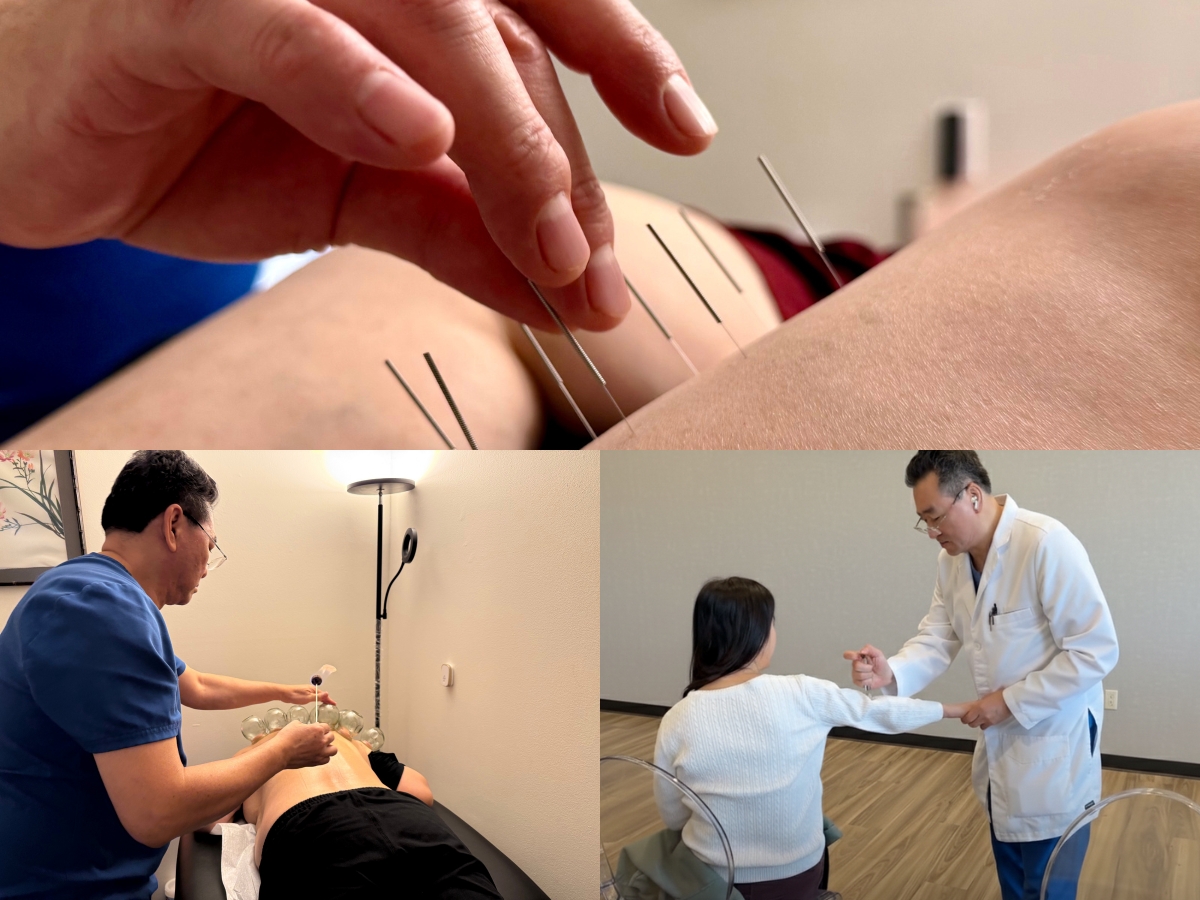 About - Painless Acupuncture Clinic in Huntington Beach, California