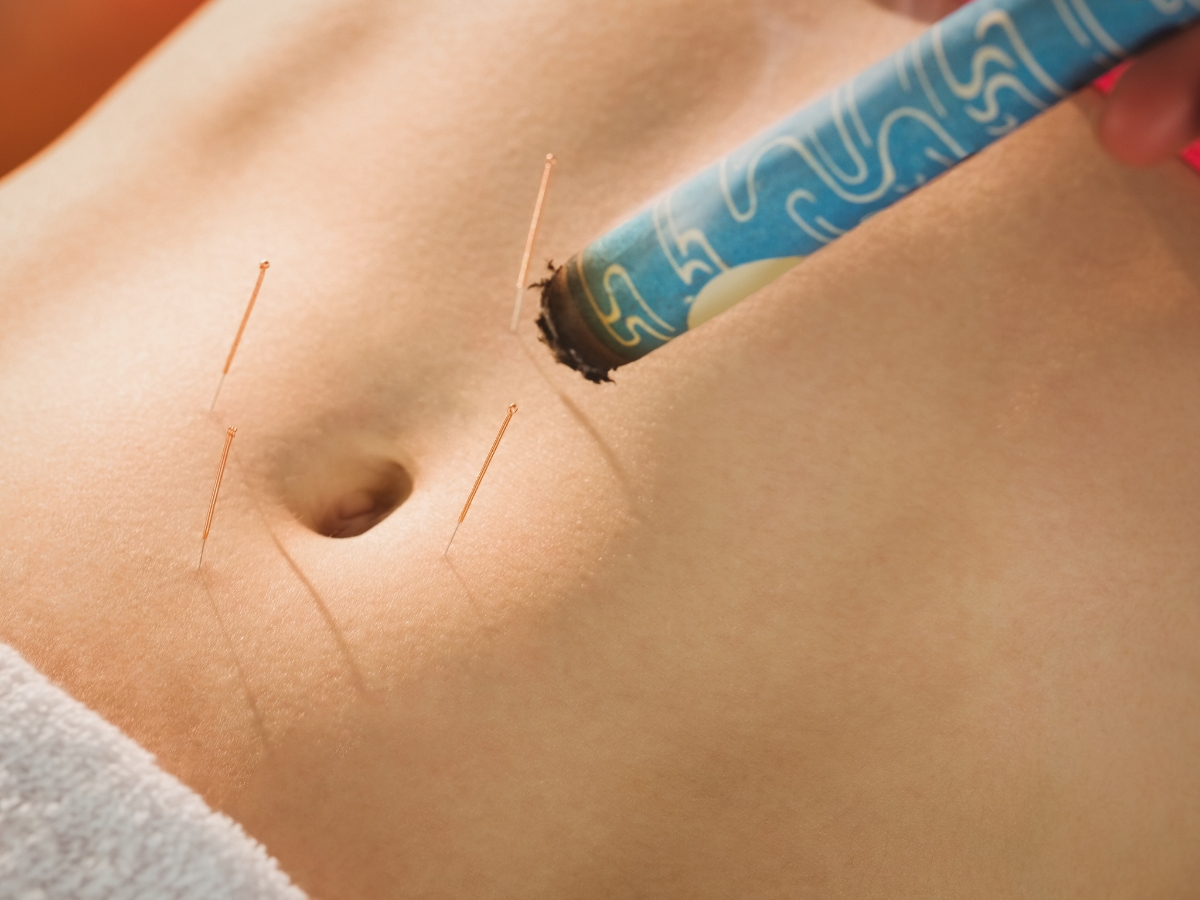 Painless Acupuncture Clinic offers safe, effective Acupuncture, Herbal Medicine, Pain Management in Huntington Beach, California