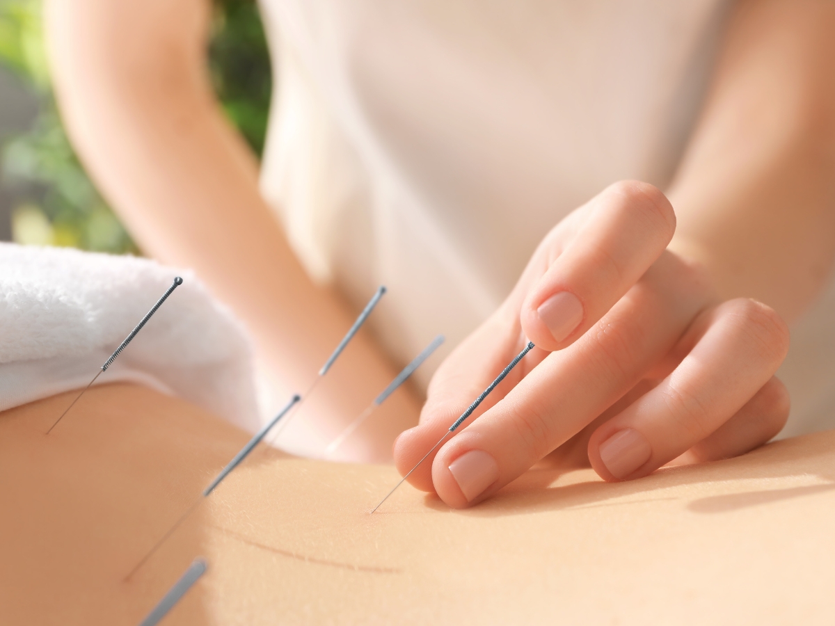 Health Insurances - Painless Acupuncture Clinic in Huntington Beach, California