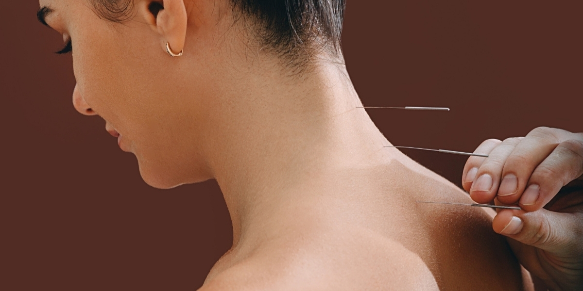 Painless Acupuncture Clinic in Huntington Beach, California