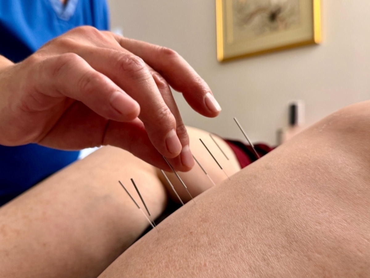 Overcoming the Fear of Needles: A Gentle, Medical Approach to Acupuncture, Painless Acupuncture Clinic in Huntington Beach, California