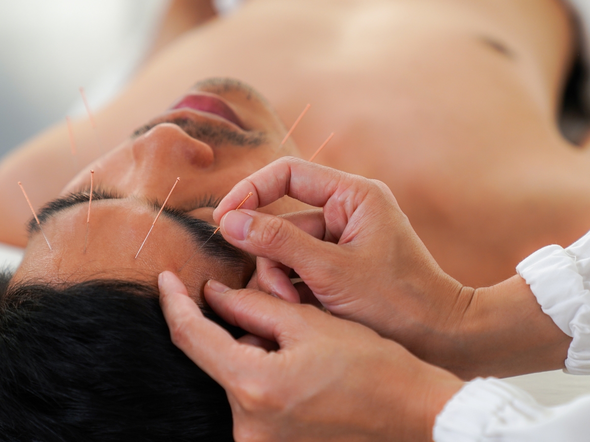 Tossing and Turning at 3 AM? Why Your Brain Needs a "Reset," Not Just Sedation, Painless Acupuncture Clinic in Huntington Beach, California