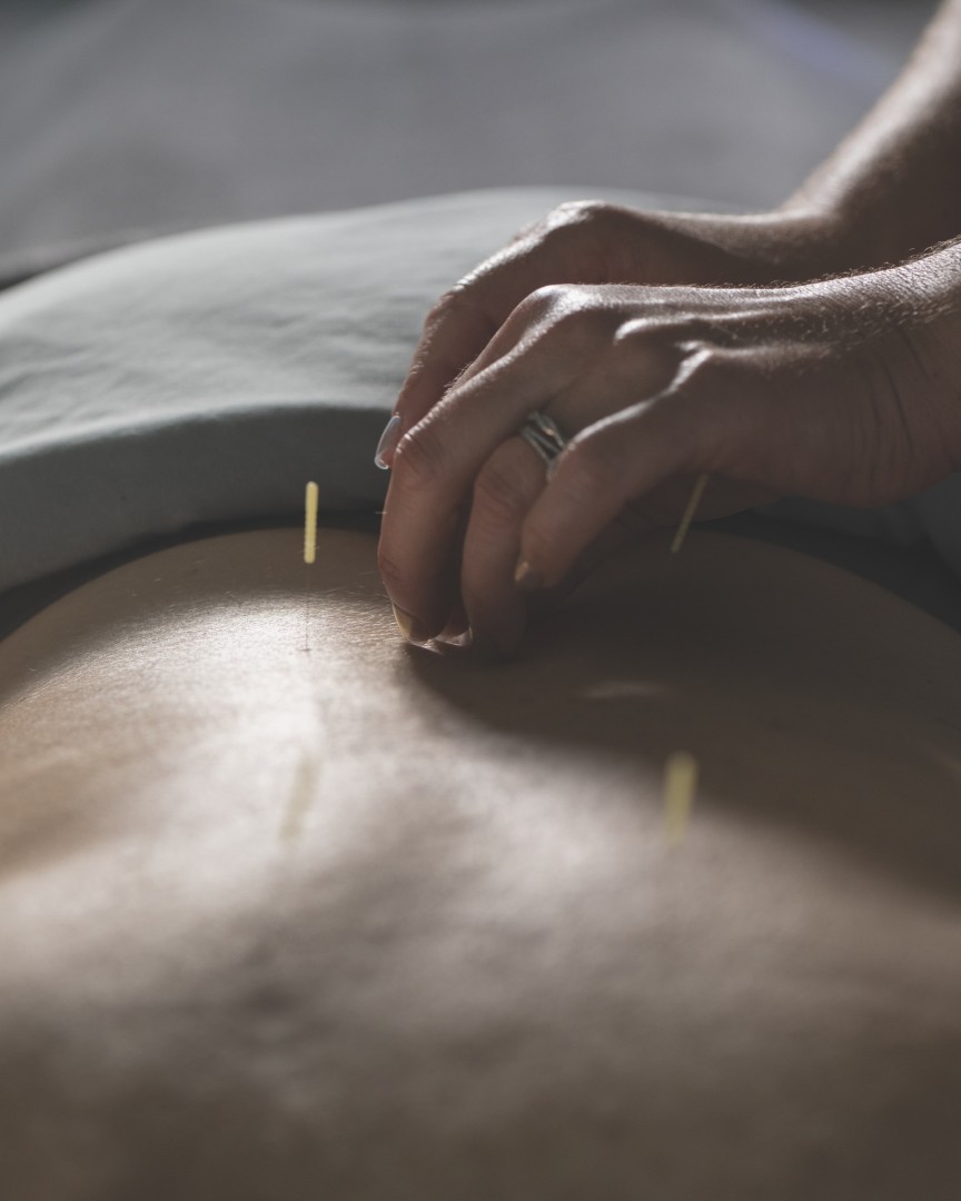 Perilla Wellness offers Acupuncture , Massage, Therapy, Reiki in Arnold, MD