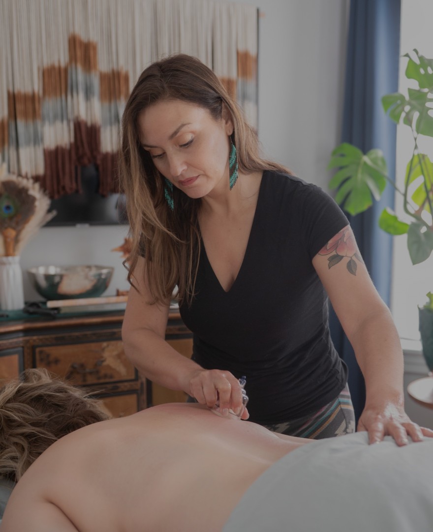 Acupuncture - Perilla Wellness in Arnold, MD