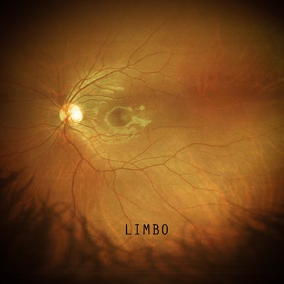 Limbo