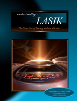 Understanding Lasik - Visual Guide