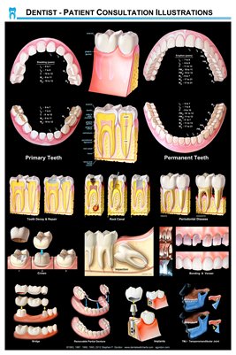 Open Dental Software Chart Module