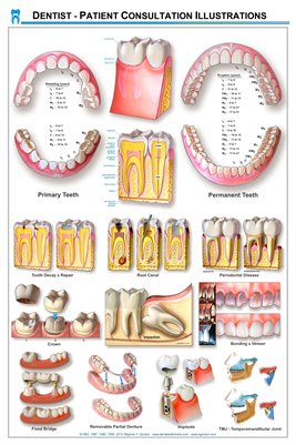 Dentist - Patient Consultation Illustrations Wall Chart -(white)DWC02