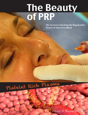 Beauty of PRP Vampire Procedures
