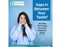 Gaps in your teeth 