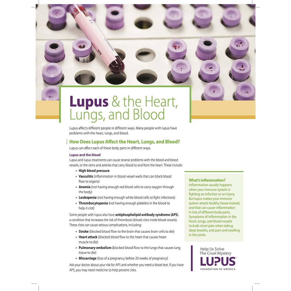 Lupus and the Heart, Lungs, and Blood Plain Language Fact Sheet (50