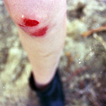 blood