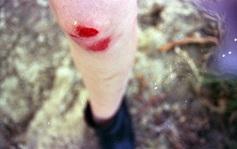 blood (S)