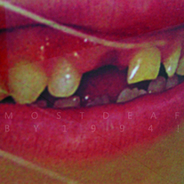 1994! “Most Deaf” 7" (Kiss of Death)