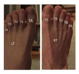 C7s2 anatomical mod image