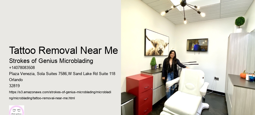 Tattoo Removal Near Me