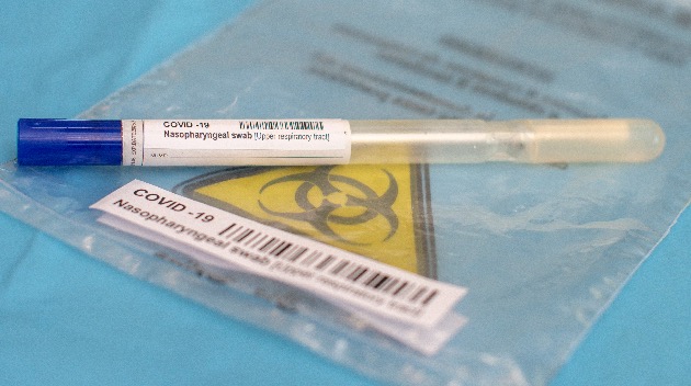 COVID-19 live updates: US daily cases drop from 807,000 to 134,000 in one month COVID-19 live updates: US daily cases drop from 807,000 to 134,000 in one month