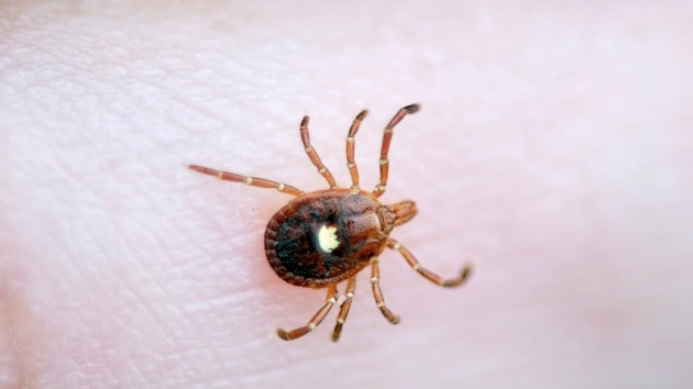 New Jersey man believed to be 1st known death from red meat allergy linked to tick bites