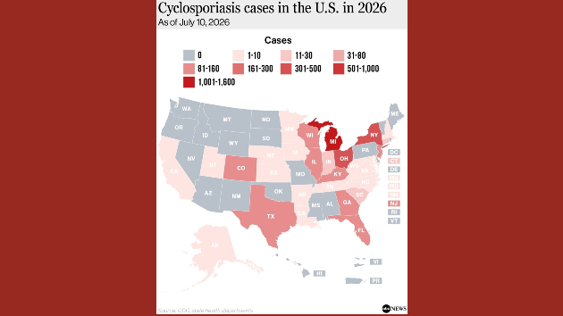 Here's where cyclosporiasis is spreading as cases are confirmed in 32 states