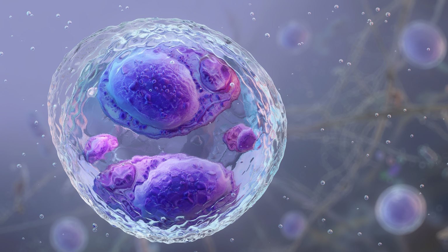 1st deaths in cyclosporiasis outbreak reported in Michigan as cases surpass 11,000