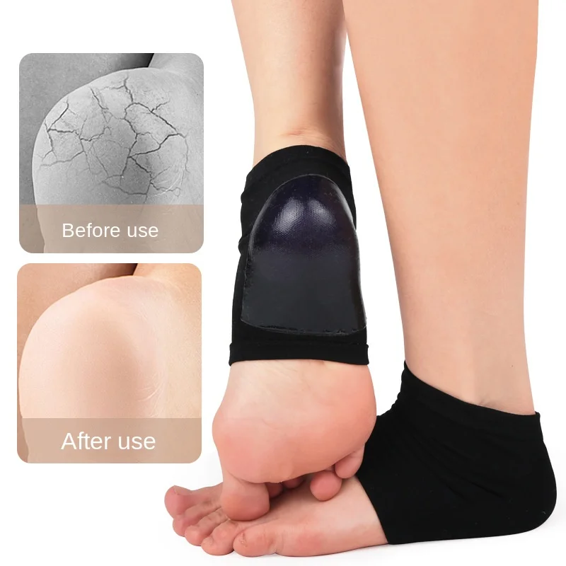2-Pack Moisturizing Gel Heel Socks – Open-Toe Spa Socks for Dry, Cracked Heels