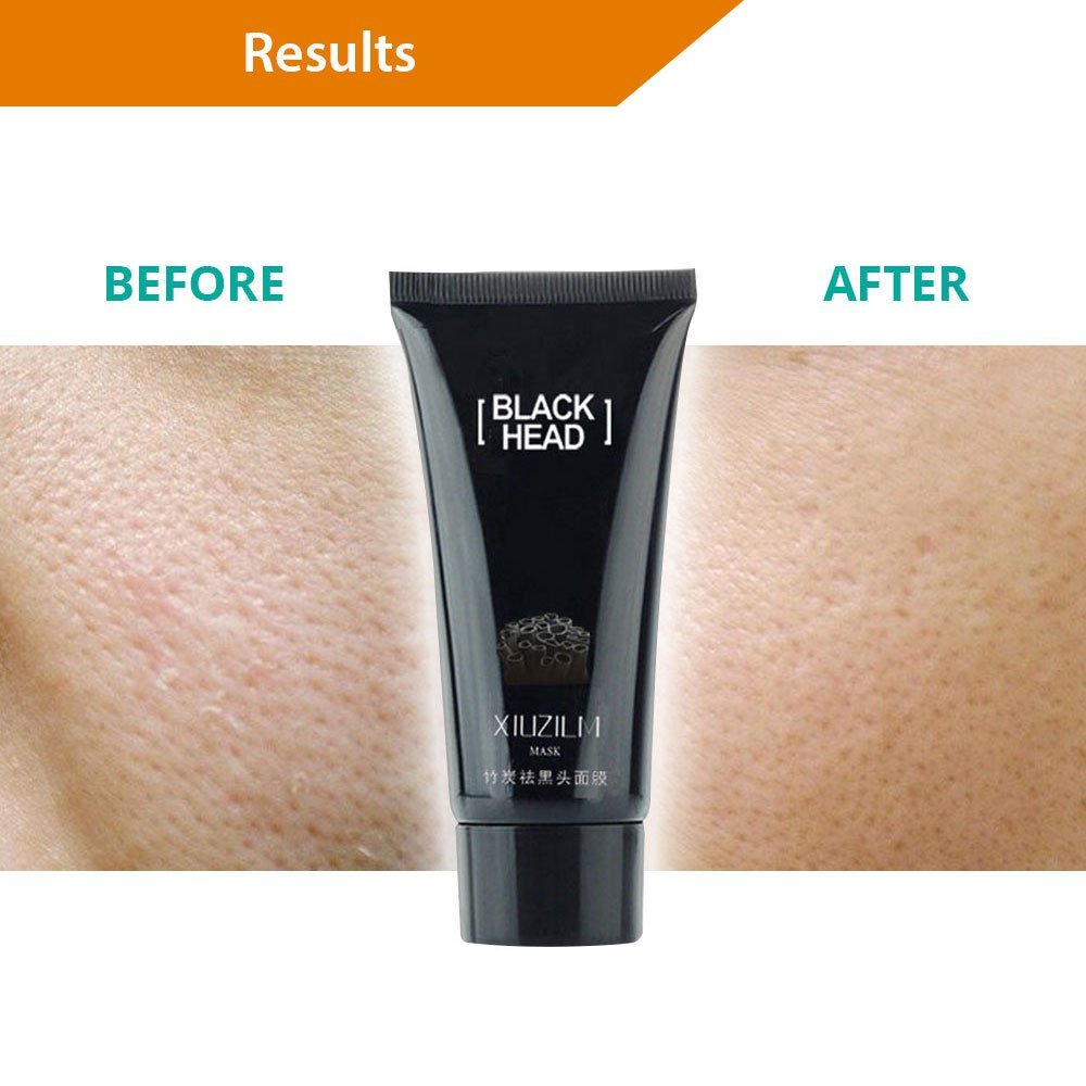 PeelOff Face Mask Blackhead Remover with Micro Derma Roller BelleChic