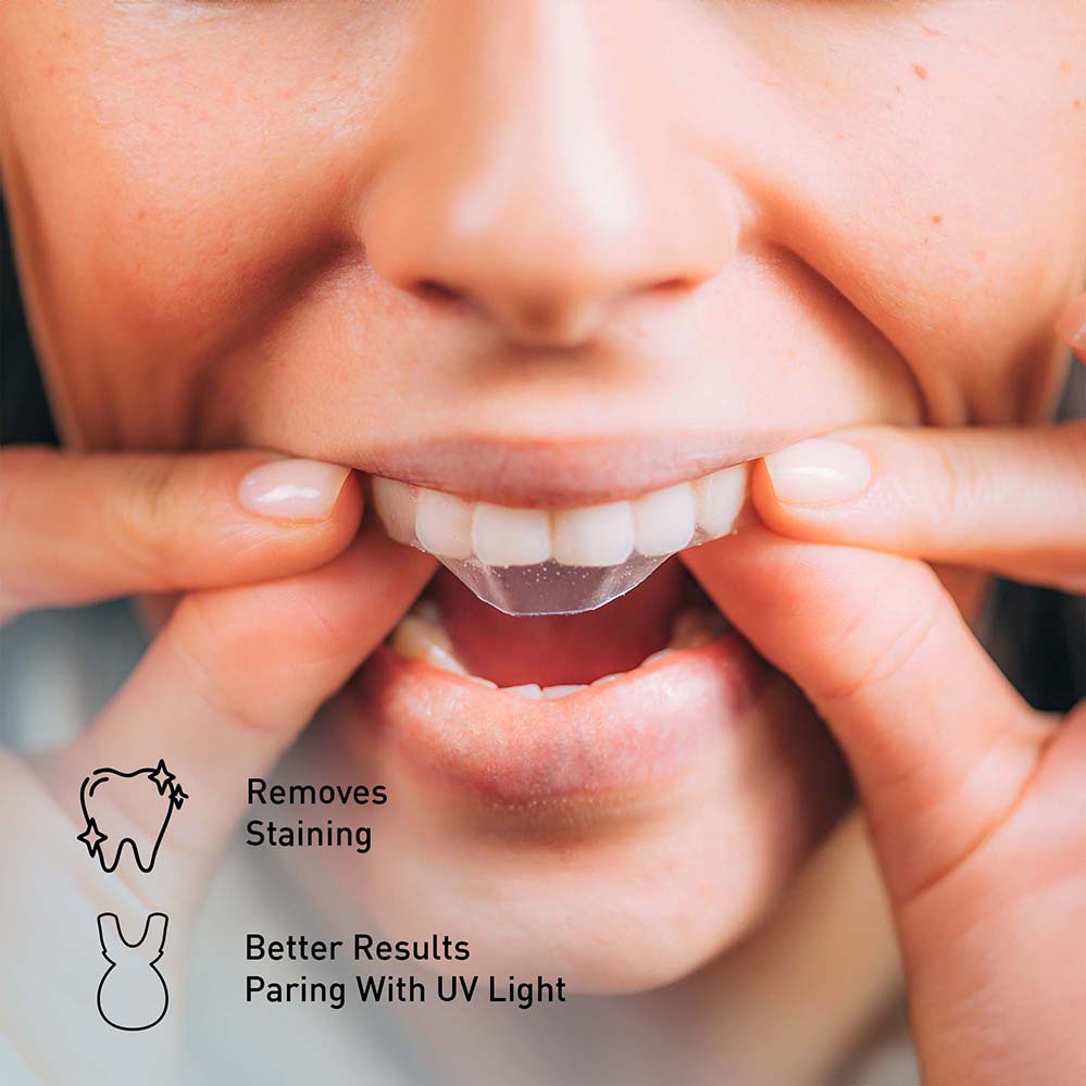28-Pack Pursonic Teeth Whitening Strips - Non-Toxic & Peroxide-Free - Professional Instant Teeth Whitening(14 Upper and 14 Lower)