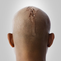 egg head