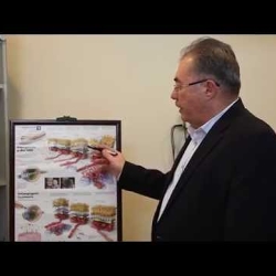 eye world center commercial 
