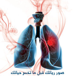 Awareness Campaigns