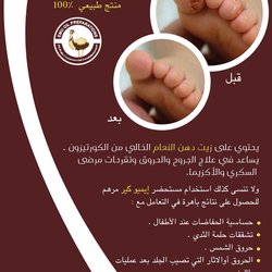 بروشور طبي إميو كير /EMUCARE Brochure 