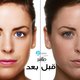 تنعيم البشرة 2