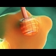 Honey 3d