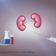 kidney renal biopsy
