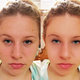 Retouching 