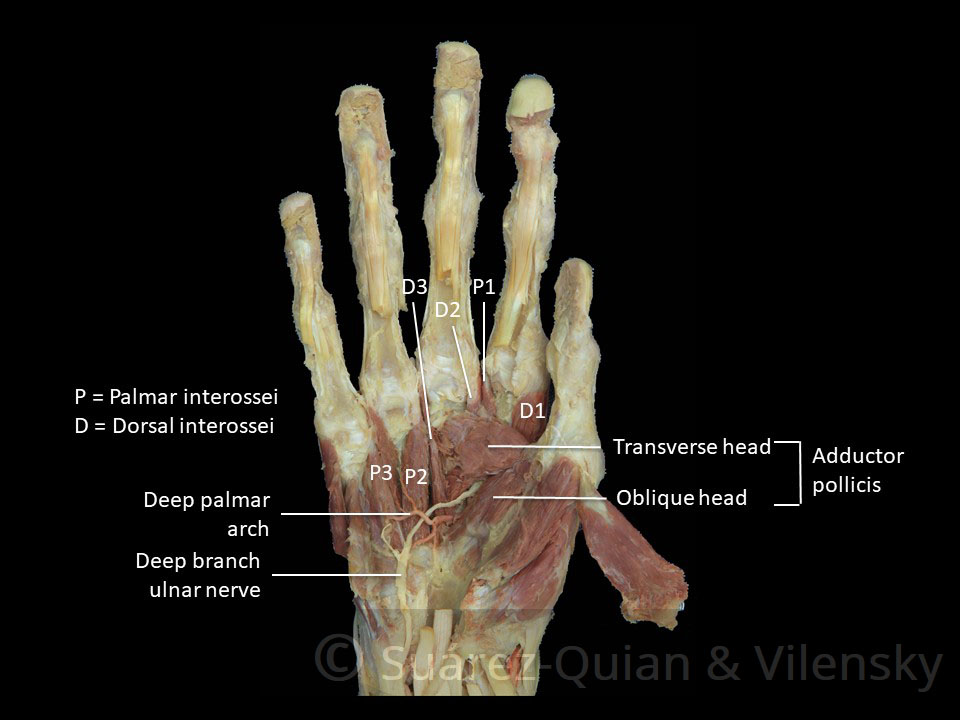 The Muscles of the Hand - Thenar - Hypothenar - TeachMeAnatomy
