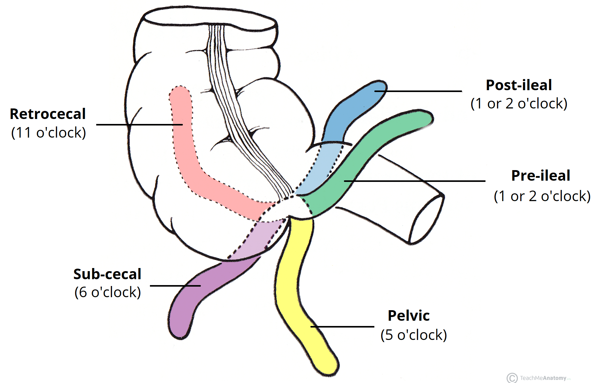 Diagram Of Appendix