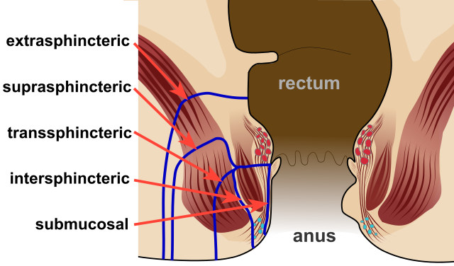 anal fluid replacement Wifes nude bubble butt