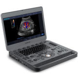 Ultrassom Veterinário SonoScape X3V