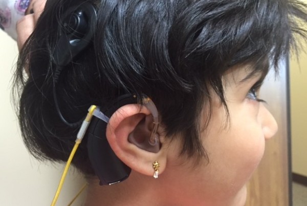New Technology Brings Sound To Little Girl