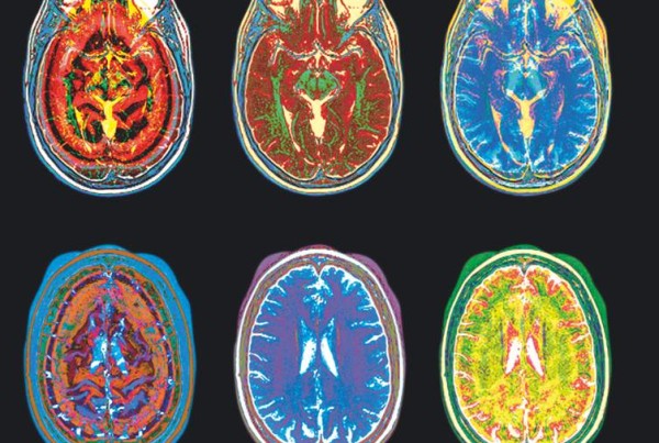 Do Law Students Need Brain Training? Texas Tech Is Giving It A Shot