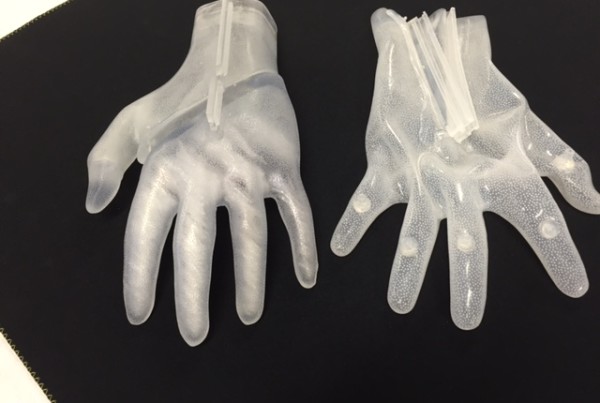 A Healing Glove for Hand Injuries Takes Shape at UT Arlington