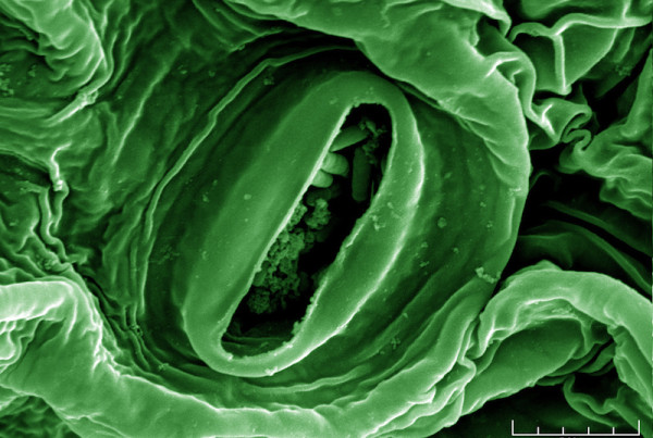 How Does E. Coli Get Into Your Burrito?