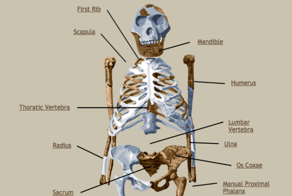 Did Lucy, the 3-Million-Year-Old Hominid, Fall from a Tree?