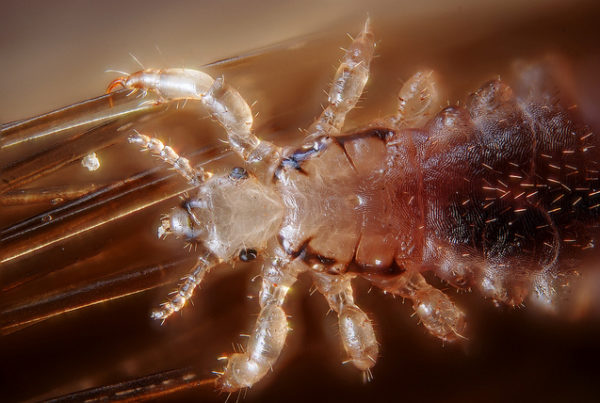 Did Your Kid Get Head Lice? Don’t Panic – Here’s What to Do