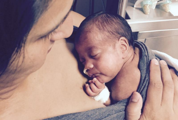 Kangaroo Care May Help Drug Dependent Babies