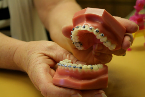 When It Comes To DIY Braces, Orthodontists Say Don’t Try This At Home