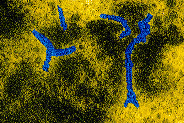 Where To Point The Finger As Mumps Cases In Texas Hit A 20-Year High