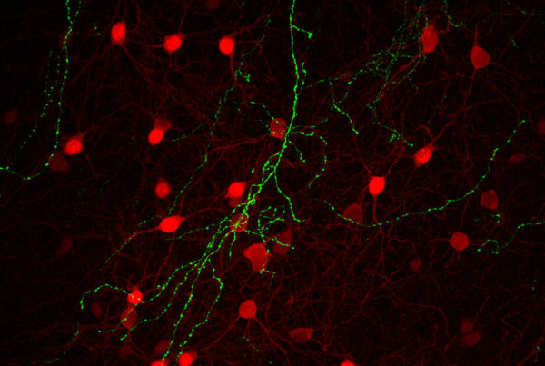 Half And Half: San Antonio Scientists Look At How Brain Hemispheres Communicate